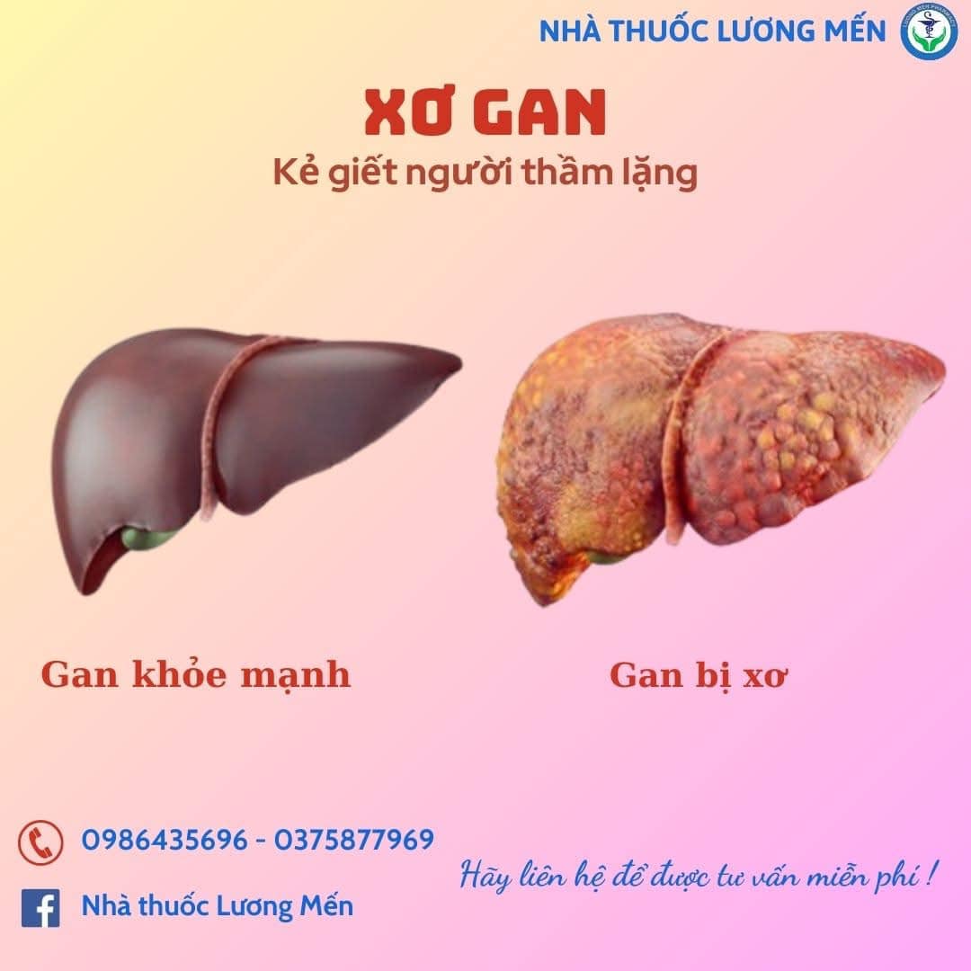 Xơ gan-kẻ giết người thầm lặng